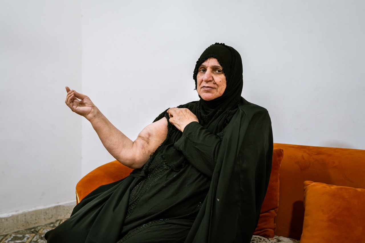 Groß (8 - Fadela Khushain- 67- has bone cancer in her arm. - 3b48e4b5-5b05-476b-a346-39a32