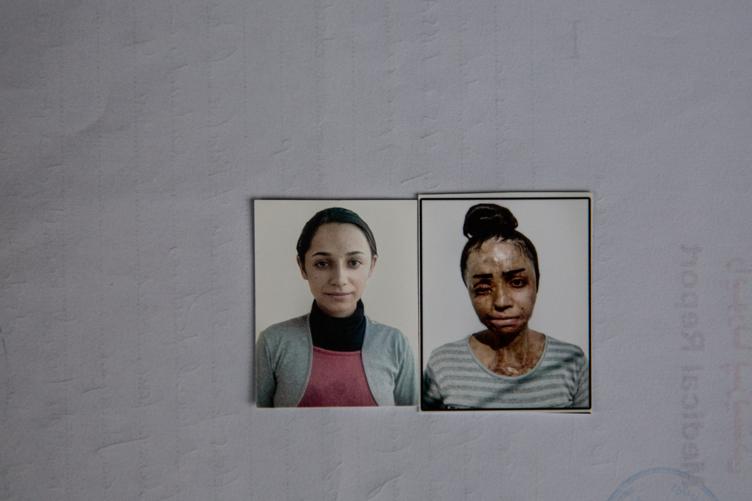 Self-immolation among the Kurdish Women